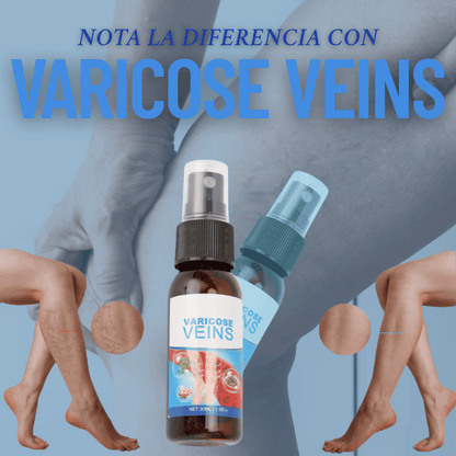 VARICOSE VEINS®: Disminuye las VARICES en POCO TIEMPO! + PARCHES DE REGALO 🎁 Y ENVÍO GRATIS 🚚